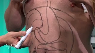 Här ritar experten på Anders Pihlblad mage för att visa magens funktioner - Malou Efter tio (TV4)
