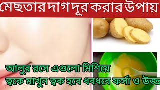 আলুর রসে কি মেশালেখুব তাড়াতাড়ি মেছতা দূর হয়ে দাগহীন ফর্সা ত্বক পাবেন Potato juice for glowing skin