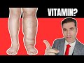 Koji je najvažniji VITAMIN za uklanjanje OTEKLINA NOGU,RUKU, ZGLOBOVA ...?