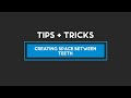 DIBS AI Tips and Tricks: Creating Space Between Teeth