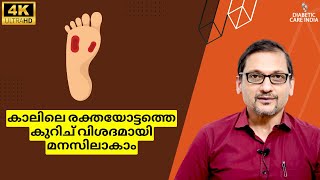 കാലിലെ രക്തയോട്ടത്തെ കുറിച് വിശദമായി മനസിലാകാം | Dr.Satish Bhat's | Diabetic Care India