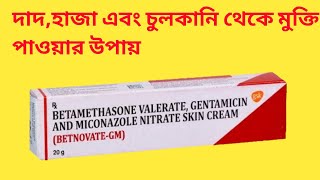 BETNOVATE GM SKIN CREAM (বেটনোভেট জিএম ক্রিম এর কাজ কি) BETNOVATE GM CREAM BANGLA REVIEW