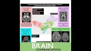 Magnetic resonance imaging pattern recognition in childhood bilateral basal ganglia disorders