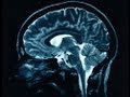 Brain Reconstruction: The next biomedical breakthrough, or a biological impossibility?