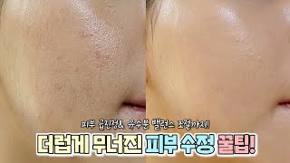 여름철 더럽게 무너진 메이크업! 쉽고 빠르게 수정하는 꿀팁, 피부 급진정까지ㅣ진짜 믿으세요👍- [귄펭]