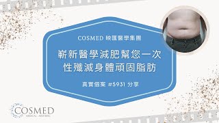 【冷凍溶脂 Cooltech Define​】真實對比圖 定點瘦身話咁易！COSMED 一次性醫學減肥纖體療程 同肚腩講bye bye！(2021)