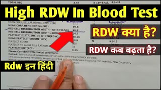 Rdw blood test hindi || High RDW In Blood Test || Rdw test means || Rdw test report
