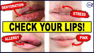 10 Things Your Lips Say About Your Health | Must See!