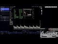 Настройка и регулировка импульсного доплера на УЗ сканере HS30 Samsung Medison