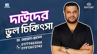 দাউদের ভুল ট্রিটমেন্ট - দাদের ভুল চিকিৎসা