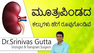 Hi9 |ಮೂತ್ರಪಿಂಡದ ಕಲ್ಲುಗಳು ಹೇಗೆ ರೂಪುಗೊಂಡಿವೆ| How are Kidney Stones Formed |Dr. Srinivas Gutta