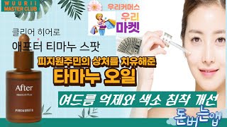 [우리마스터클럽] 🔊클리어 히어로 애프터 티마누 스팟/여드름 억제와 색소 침착 개선/피지원주민의 상처를 치유해준 타마누오일[자막📃\u0026음성지원 🔊]