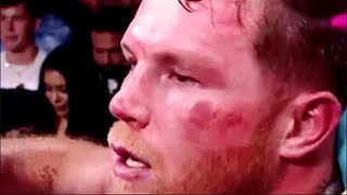 Canelo vs Boxing Legend Champion | Latest Boxing fight highlights 2024