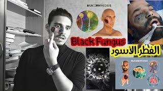 الفطر الأسود أسبابه أعراضه وعلاجه - Black fungus causes, symptoms and treatment