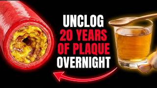 Doctors Are Calling This the #1 Silent Killer & It Hides Inside Your Arteries for 20 Years