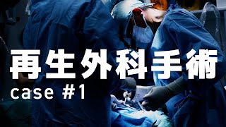 歯科医師「吉野敏明」再生外科手術 case #1