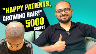 5000 Grafts Hair Transplant – My Experience 😎 | Ch. Sambhaji Nagar/Aurangabad | New Roots