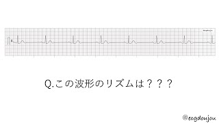 1/20心電図道場解説