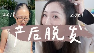 【不做秃头女孩】产后脱发怎么办？产后生发视频来啦！掉的头发全靠它们长回来！私藏生发产品推荐 能让发量显多的独家小窍门分享｜Postpartum Hair Care Tips