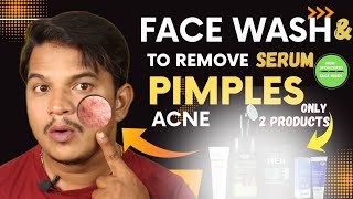 How To Remove Pimples In Just 6 Days! | Telugu | You Only Need 2 Products To Remove PIMPLES , ACNE