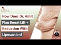 How does Dr. Amit Gupta Plan Breast Lift Plus Breast Reduction with Liposuction?