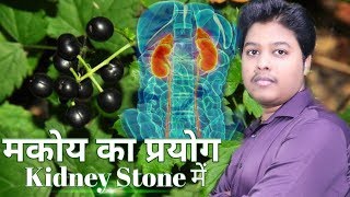 मकोय का प्रयोग_ Kidney Stone | Be_Your_Doctor | Hindi | Health Tips_By Priyabrata | Prayaas Tv