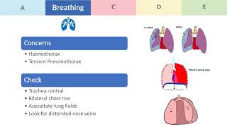 Approach to the multiple injured patient