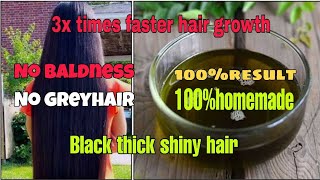 Miracle Hair oil முடி உதிராம கரு கருனு அடர்த்தியா இளநரை தடுத்து வளர|Miracle hair growth oil