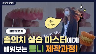 Dental 총의치 제작과정 설명하기