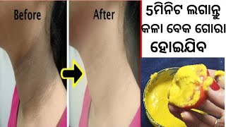 dark neck|dark neck home remedies |dark neck whiten|neck whitening at home|gora hone ka tarika