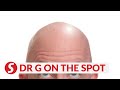 EP44: Correlation between baldness and virility? | PUTTING DR G ON THE SPOT