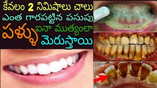 Teeth Whitening At Home In 2 Min || How To Naturally Whiten Your Teeth || 100% Result 😍 || Smart Sar