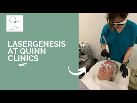 Laser Genesis Skin Treatment Demonstration – at Quinn Clinics MediSpa, Bristol
