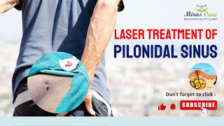 Laser treatment of pilonidal sinus - By Dr Mir Asif Rehman - Pilonidal Sinus Surgery in Gurgaon