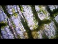 elodea leaf under microscope