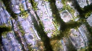 Elodea leaf under microscope