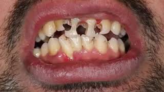 الدكتور الاختصاصي محمد بندي GRNJIN DENTAL CENTER