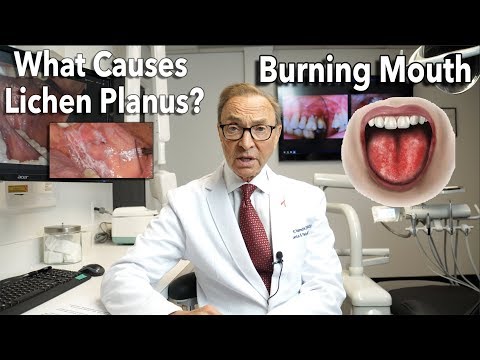 Does Oral lichen planus go away?