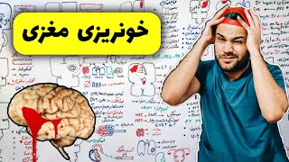 خونریزی داخل مغزی | ICH | علایم | علت | درمان