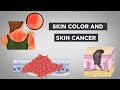 Evo-Ed: Skin Color and Skin Cancer