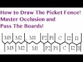 Occlusion - Picket Fence - NBDE Part 1 Boards Study