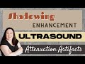 Ultrasound Physics Review | Attenuation Artifacts | Sonography Minutes