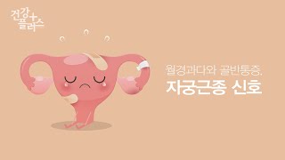 자궁근종 [건강플러스]