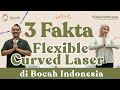 3 Fakta Flexible Curved Laser di Bocah Indonesia