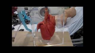 RESPIRATORY CARE  Effect of Suctioning