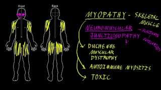 Myopathy and neuromuscular junctionopathy