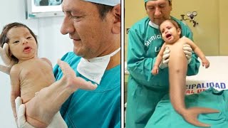 ऐसी अजीब परेशानियों के साथ पैदा हुए ये 10 बच्चे - Unusual Kids Born with Unbelieva Medical Condition