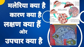 मलेरिया: लक्षण, कारण और बचाव के उपाय #nursingvilla #doctor #malariatreatment