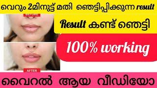 ജന്മനാ ഉള്ള കറുത്ത ചുണ്ടുകൾ വരെ സ്ഥിരമായി ചുവപ്പിക്കാൻ അടുക്കളയിലെ 2 സാധങ്ങൾ  Redlips Home Remedy