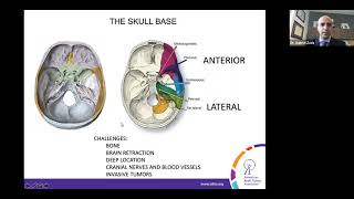 We Need to Talk About the Location of Brain Tumors